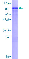 12.5% SDS-PAGE Stained with Coomassie Blue.